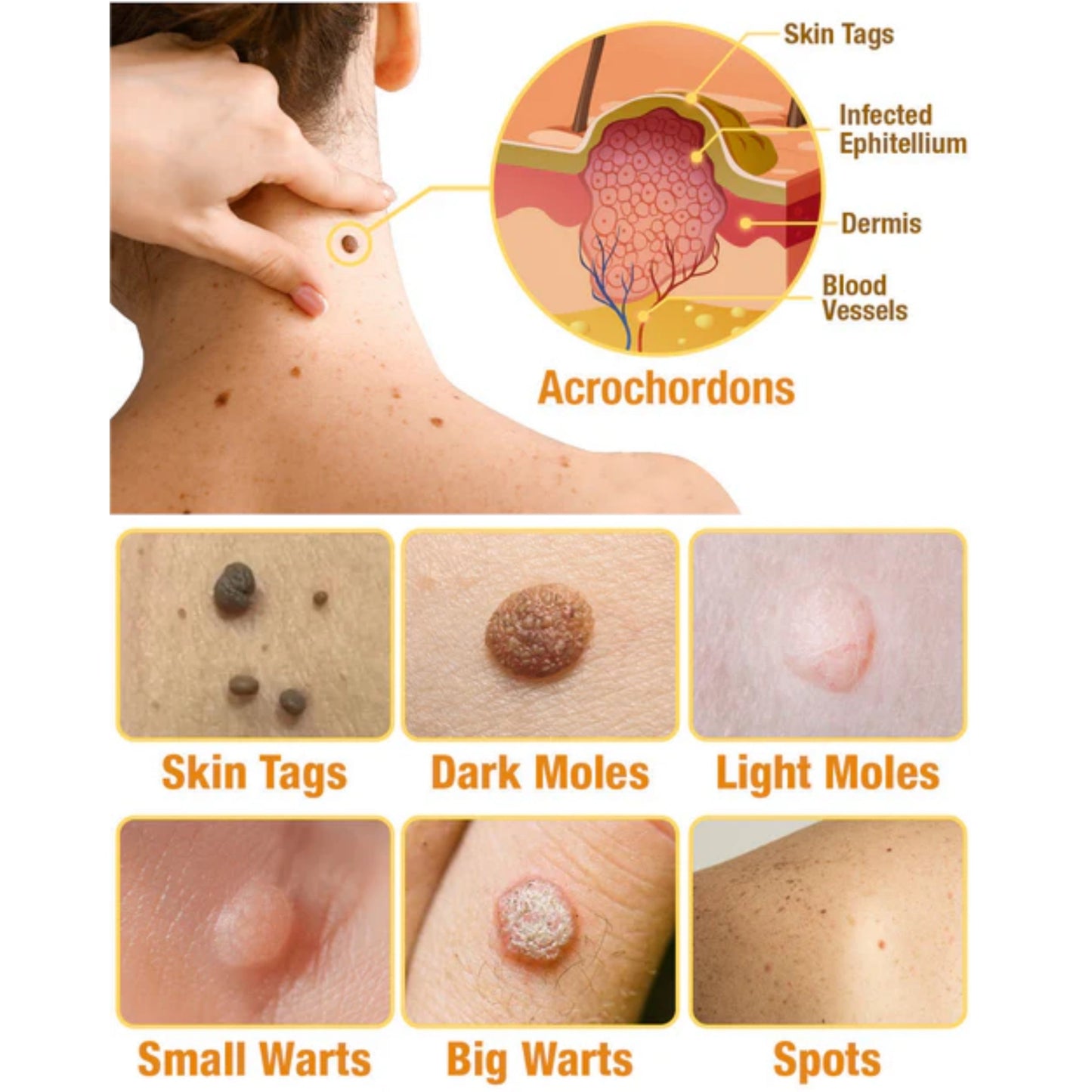 đLOVILDS⢠TagRecede Bee Venom Treatment Spray