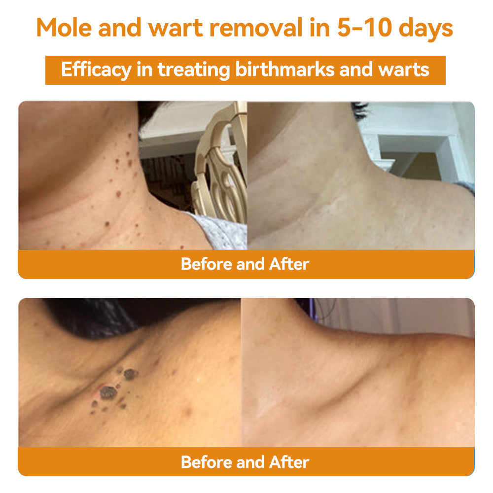 đLOVILDS⢠TagRecede Bee Venom Treatment Spray