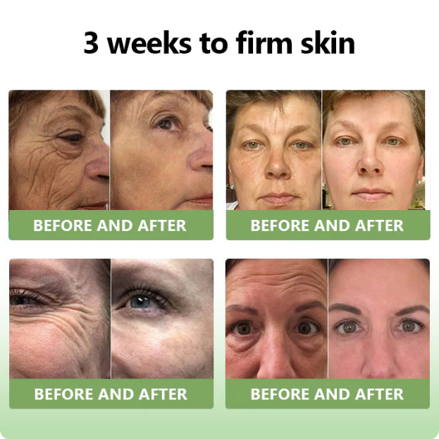 ✅MHRA Certified💝DivGlow™ Luxurious Collagen Peptide Firming Cream🔥Maximum 75% OFF!🔥