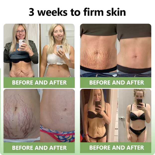 ✅MHRA Certified💝DivGlow™ Luxurious Collagen Peptide Firming Cream🔥Maximum 75% OFF!🔥