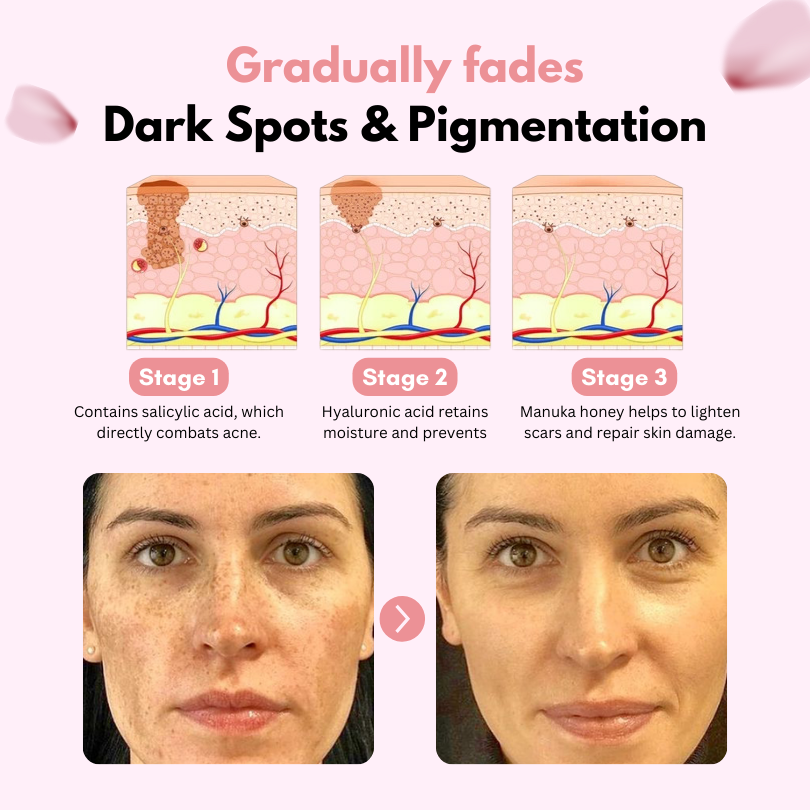 Fivfivgo™ CollagenGlow Coenzym Q10 Haut-Gelee-Creme