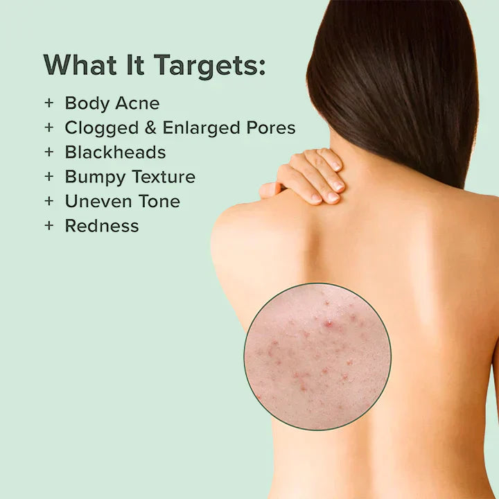 😍 😍 LuxeLife™ Back Acne Treatment Spray