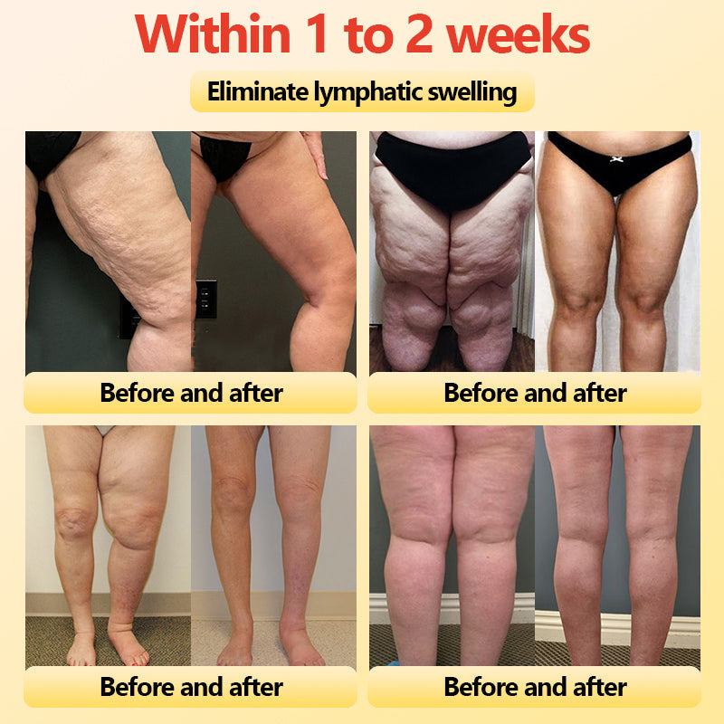 🎄Christmas Sale!🎄 | Neslemy™ Titanium Fiber Self-heating Tourmaline Shaping Shorts 💙