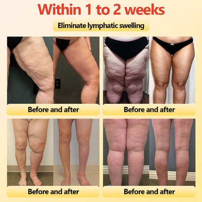 🎄Christmas Sale!🎄 | Neslemy™ Titanium Fiber Self-heating Tourmaline Shaping Shorts 💙