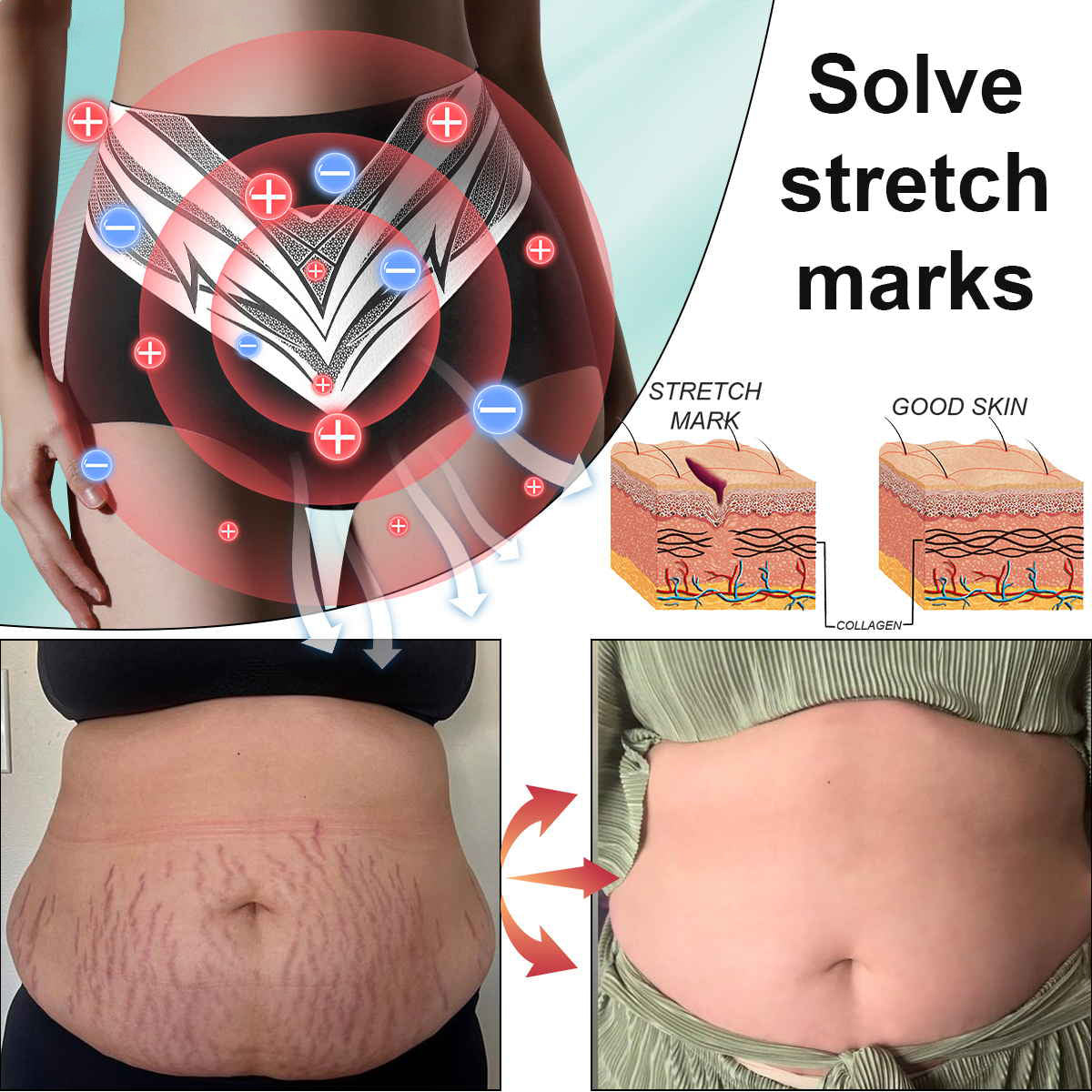 🎄Christmas Sale!🎄 | Neslemy™ Titanium Fiber Self-heating Tourmaline Shaping Shorts 💙