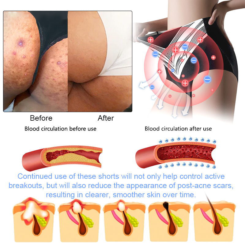 🎄Christmas Sale!🎄 | Neslemy™ Titanium Fiber Self-heating Tourmaline Shaping Shorts 💙