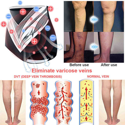 🎄Christmas Sale!🎄 | Neslemy™ Titanium Fiber Self-heating Tourmaline Shaping Shorts 💙