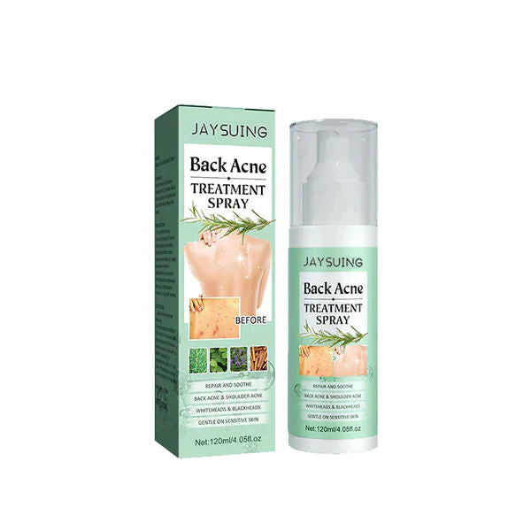 😍 😍 LuxeLife™ Back Acne Treatment Spray
