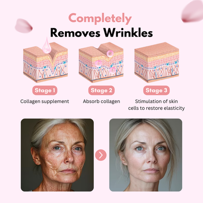 Fivfivgo™ CollagenGlow Coenzym Q10 Haut-Gelee-Creme