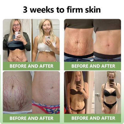 ✅MHRA Certified💝DivGlow™ Luxurious Collagen Peptide Firming Cream🔥Maximum 75% OFF!🔥