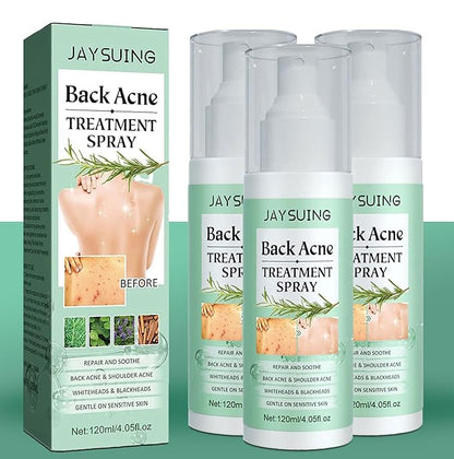 😍 😍 LuxeLife™ Back Acne Treatment Spray