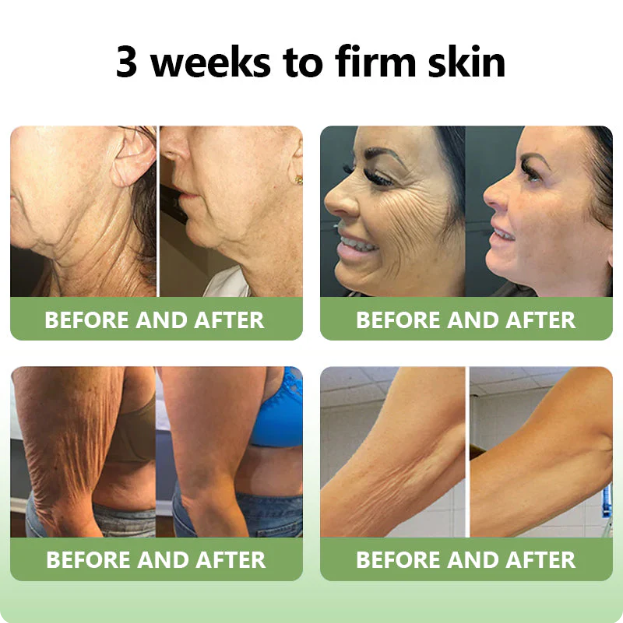 ✅MHRA Certified💝DivGlow™ Luxurious Collagen Peptide Firming Cream🔥Maximum 75% OFF!🔥