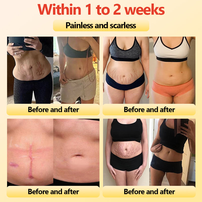 🎄Christmas Sale!🎄 | Neslemy™ Titanium Fiber Self-heating Tourmaline Shaping Shorts 💙