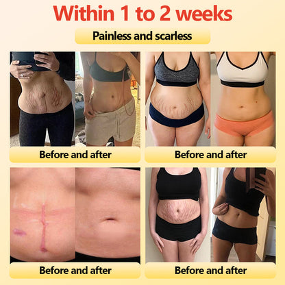 🎄Christmas Sale!🎄 | Neslemy™ Titanium Fiber Self-heating Tourmaline Shaping Shorts 💙