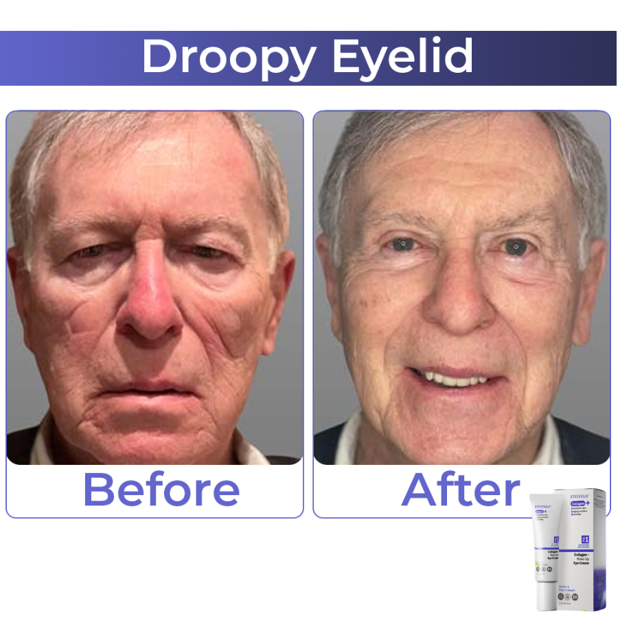 Fivfivgo™ Collagen+ Wake Up Eye Cream 🇩🇪 Dermatologist Recommended