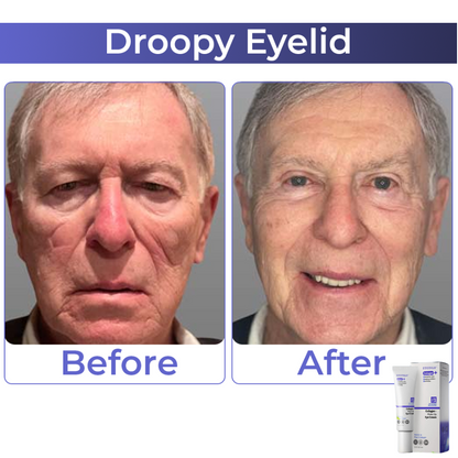 Fivfivgo™ Collagen+ Wake Up Eye Cream 🇩🇪 Dermatologist Recommended